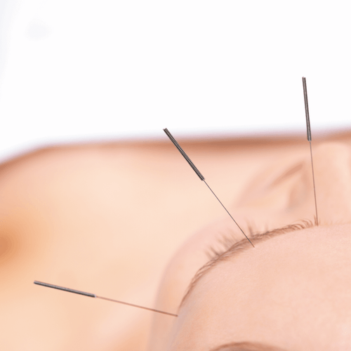 Specialization in Acupuncture