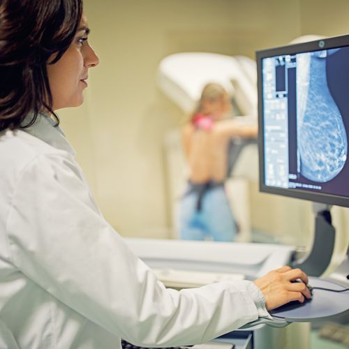 Mammography