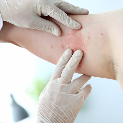 Scientific Moment – Allergy and Immunology - with certificate