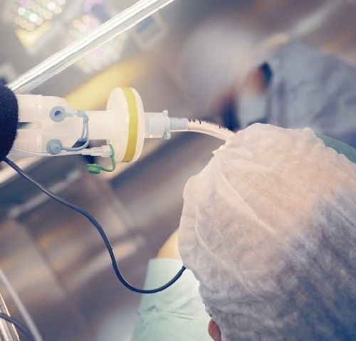 Atelier : Ventilation mécanique en anesthésie