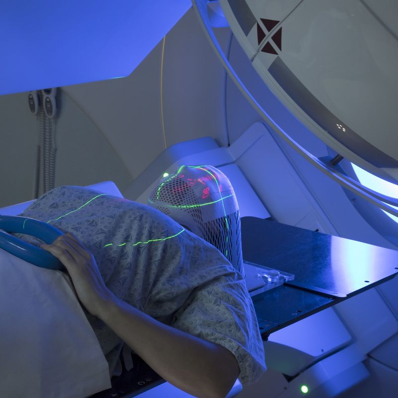 Imagem---Radioterapia-em-Oncologia