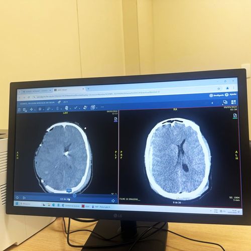 5º Curso de Atualização em Neurocirurgia USP – 2025: Neurointensivismo