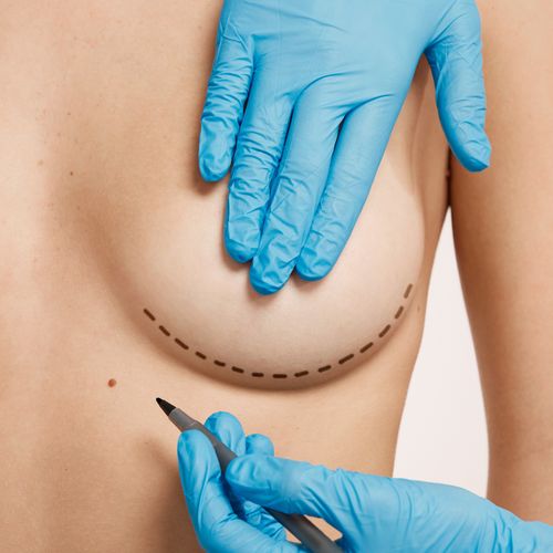 Minimally Invasive Breast Procedures