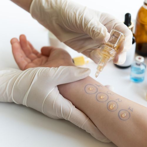 Laboratoire d'immunologie clinique et d'allergie - Programmes de bourses pour les cours de spécialisation Lato-Sensu