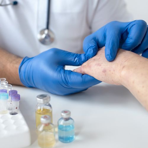 Méthodes de diagnostic et d'investigation des erreurs innées de l'immunité et des allergies - Programmes de bourses pour les cours de spécialisation Lato-Sensu