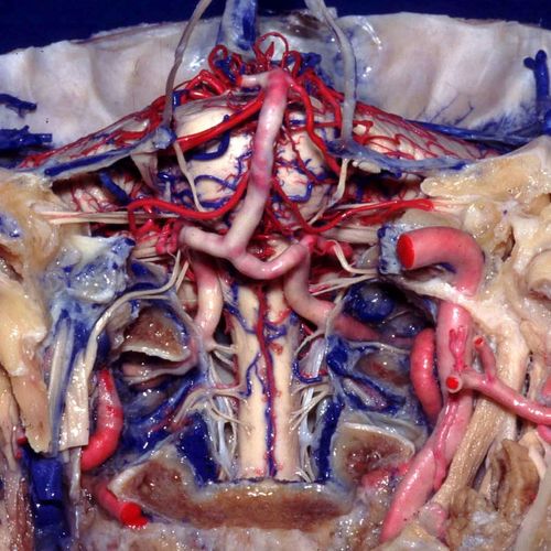 Anatomie microchirurgicale des sillons cérébraux, des circonvolutions, des ventricules, du tronc cérébral, du cervelet et du quatrième ventricule appliquée à la microneurochirurgie