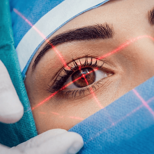 Curso Básico de Facoemulsificação