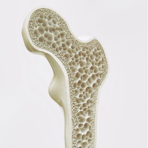 Immersion en rhumatologie de haute complexité