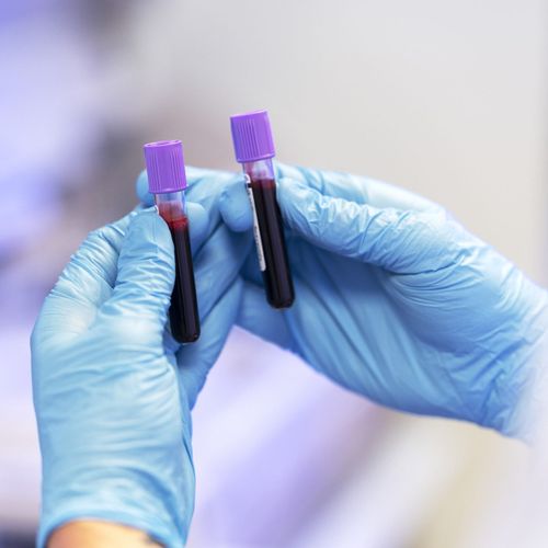 Collection of Laboratory Tests